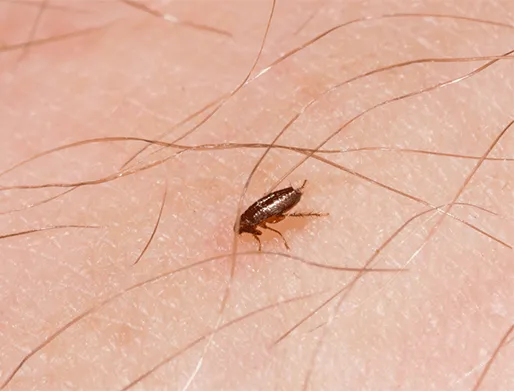 Dedetização de Pulgas em Atibaia